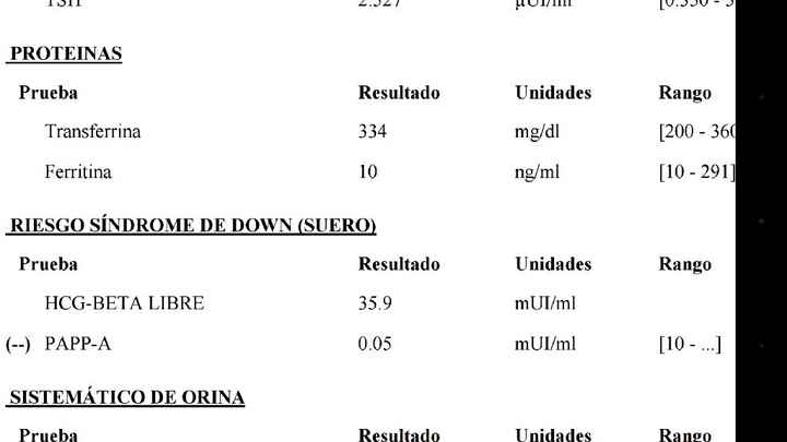 Papp-a baja... muy preocupada :s - 1