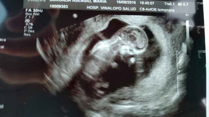 Futuras mamas febrero 2017 - 1
