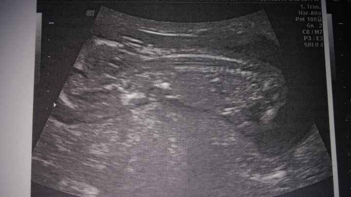 El consultorio de Lita para futuras mamis - 2