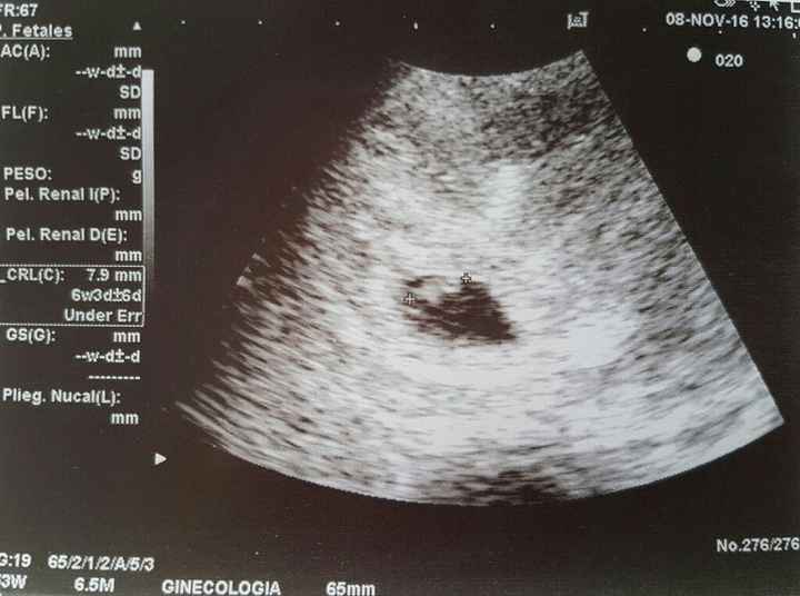 Mamis julio 2017 - 1