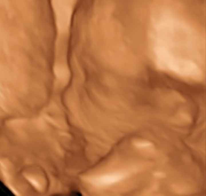 Mamis julio 2017 - 2