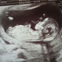 Futuras mamas septiembre 2016 - 1