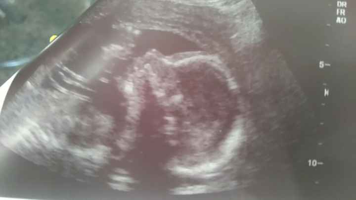 Mamis julio 2017 - 1