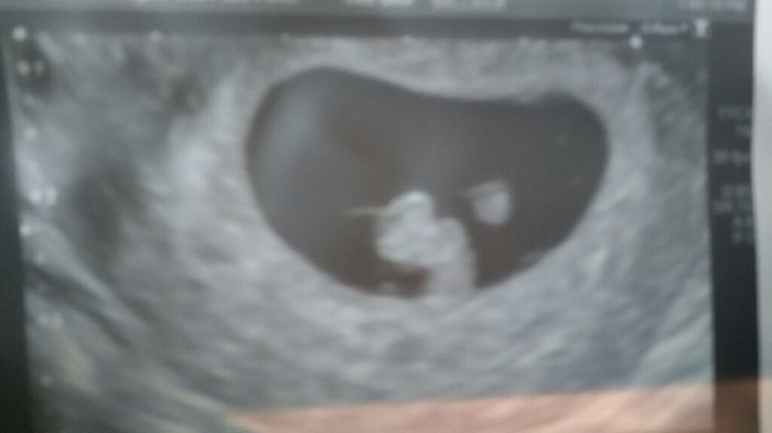 Mamis julio 2017 - 1