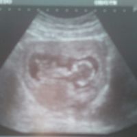 Mamis julio 2017 - 1
