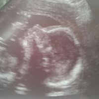 Mamis julio 2017 - 1