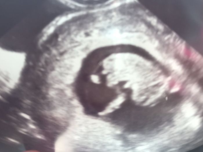 Ayuda con el sexo del bebe 2