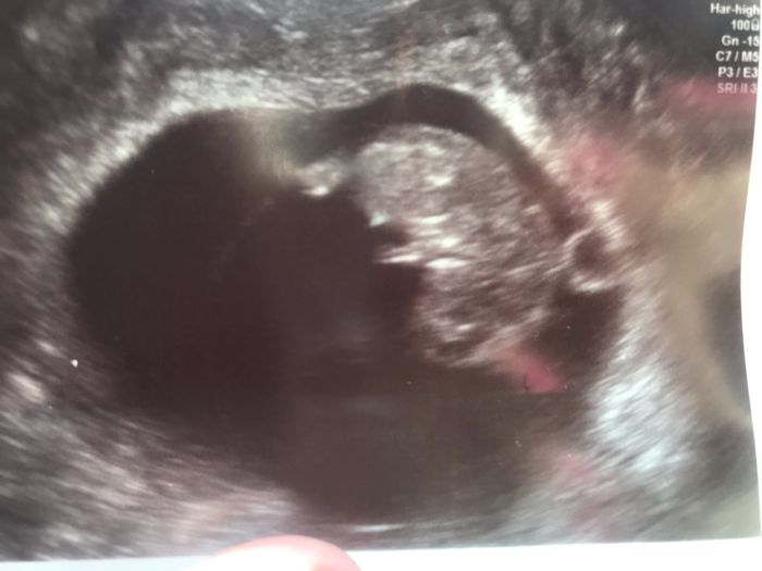 Ayuda con el sexo del bebe 3