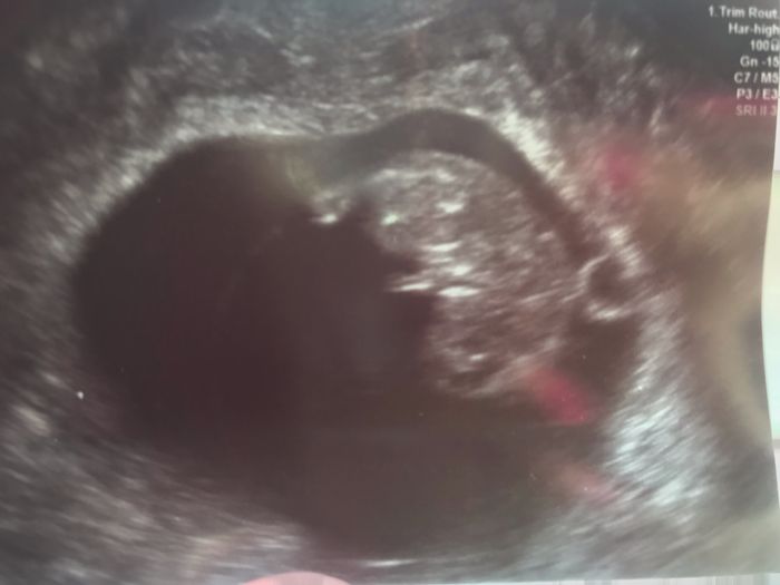 Ayuda con el sexo del bebe 4