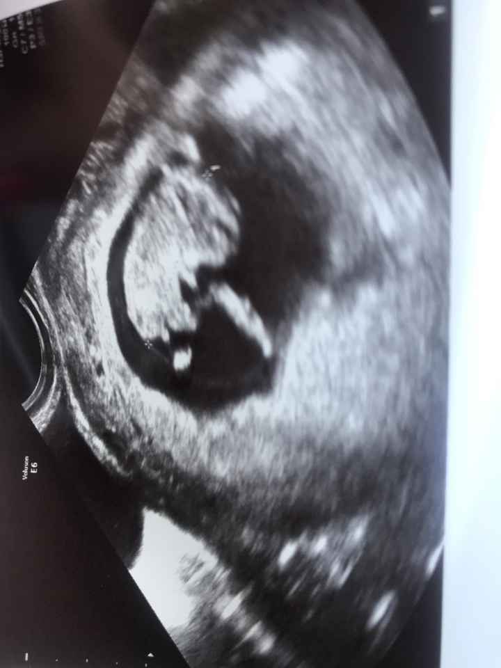 Ayuda con el sexo del bebe - 1