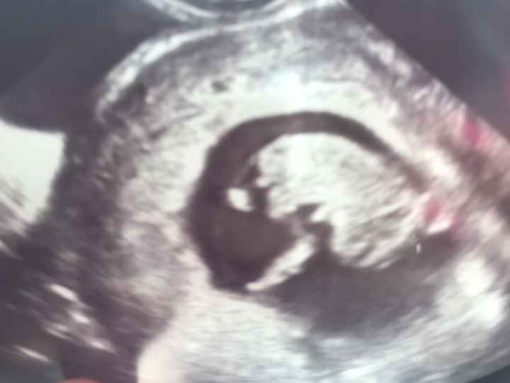 Ayuda con el sexo del bebe - 2