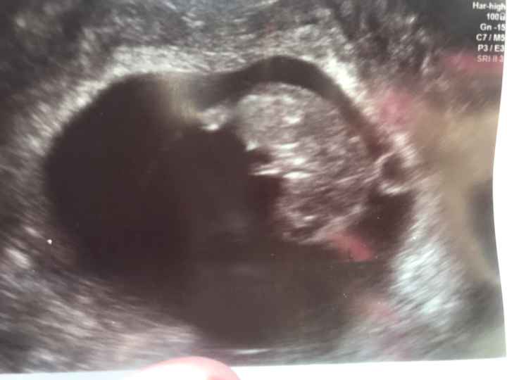 Ayuda con el sexo del bebe - 3