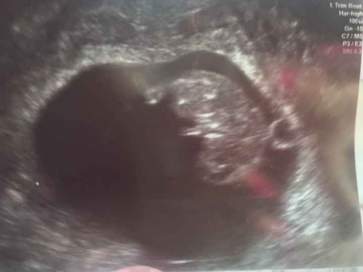 Ayuda con el sexo del bebe - 4