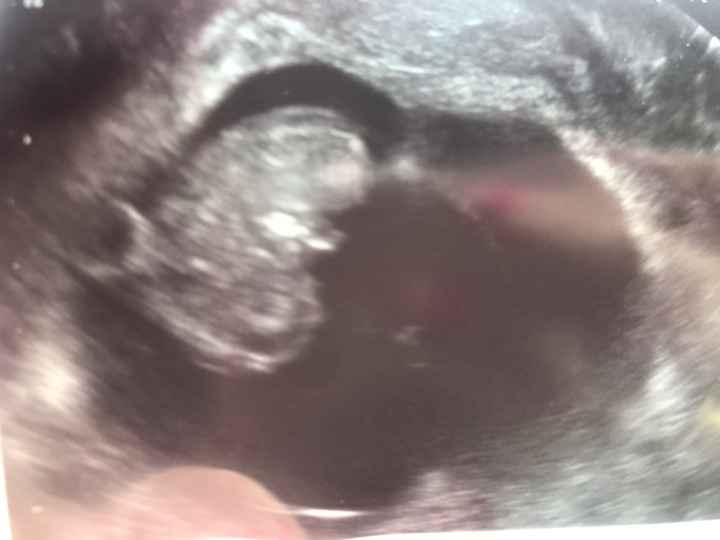 Ayuda con el sexo del bebe - 5