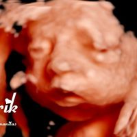 Futuras mamas noviembre 2020 - 1