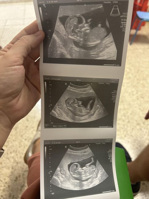 Futuras mamis abril 2025 1