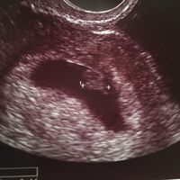 Mamis julio 2017 - 1
