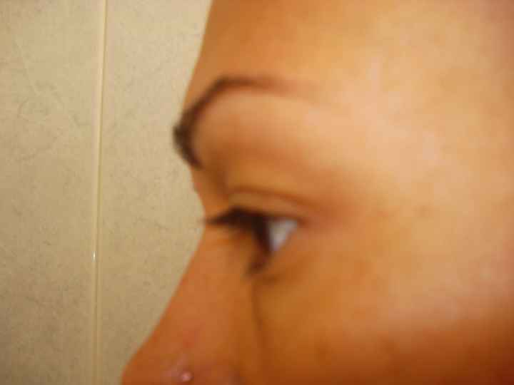Antes