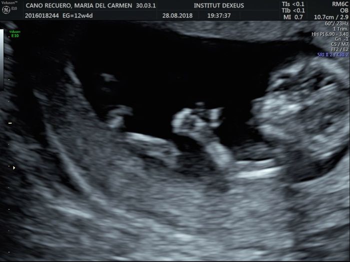 Futuras mamás marzo 2019 - 1