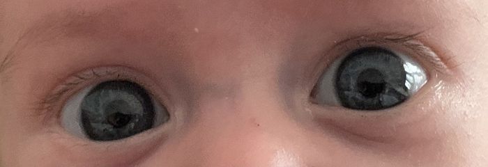 Color de ojos Recién Nacido 1