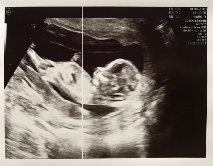 Futuras mamás marzo 2019 - 1