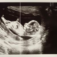 Futuras mamás marzo 2019 - 1