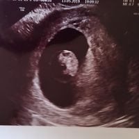 Que veis en la eco vaginal? de 8 semanas. Gracias