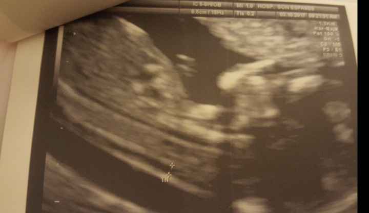 Futuras mamás abril 2018 - 1