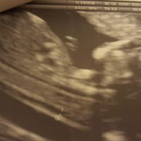 Futuras mamás abril 2018 - 1