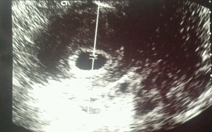 Mamis abril 2016 - 1