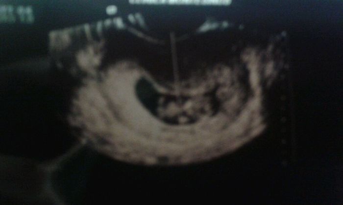 Futuras mamas julio 2016 - 1
