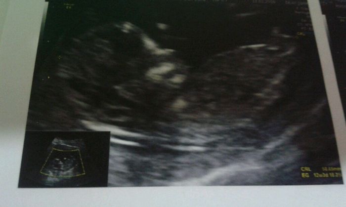 Futuras mamas julio 2016 - 1