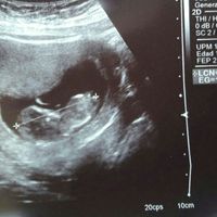  Futuras mamás Abril de 2018! - 1