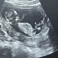  Futuras mamás Abril de 2018! - 1