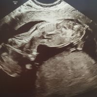 Futuras Mamas Julio 2020. - 1