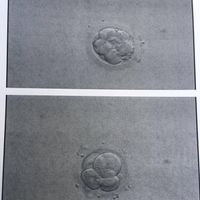 Buscadoras de sueños y milagros: IA, FIV, ICSI (Reproducción Asistida) - 1