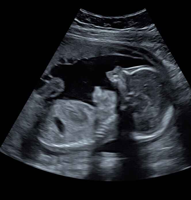 Futuras Mamás junio 2019 - 2