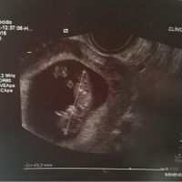 Mamis julio 2017 - 1