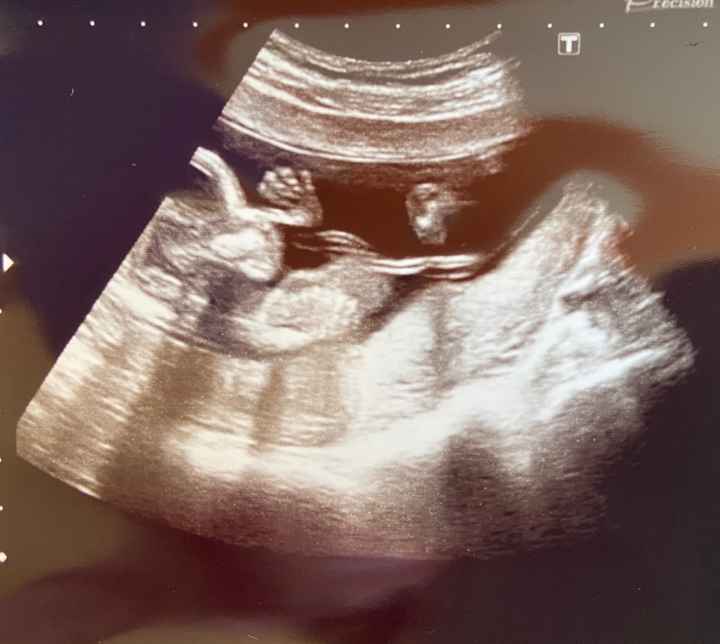 Futuras mamas octubre 2020 - 1