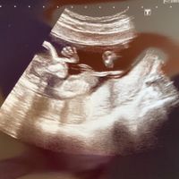 Futuras mamas octubre 2020 - 1