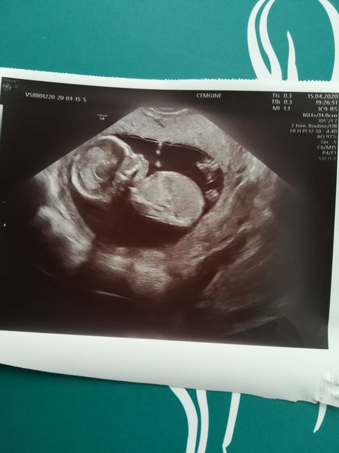 Futuras mamas octubre 2020 - 1