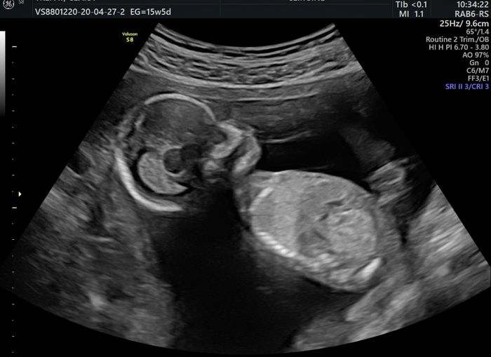 Futuras mamas octubre 2020 - 1