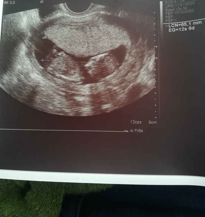 Futuras mamas octubre 2020 - 1
