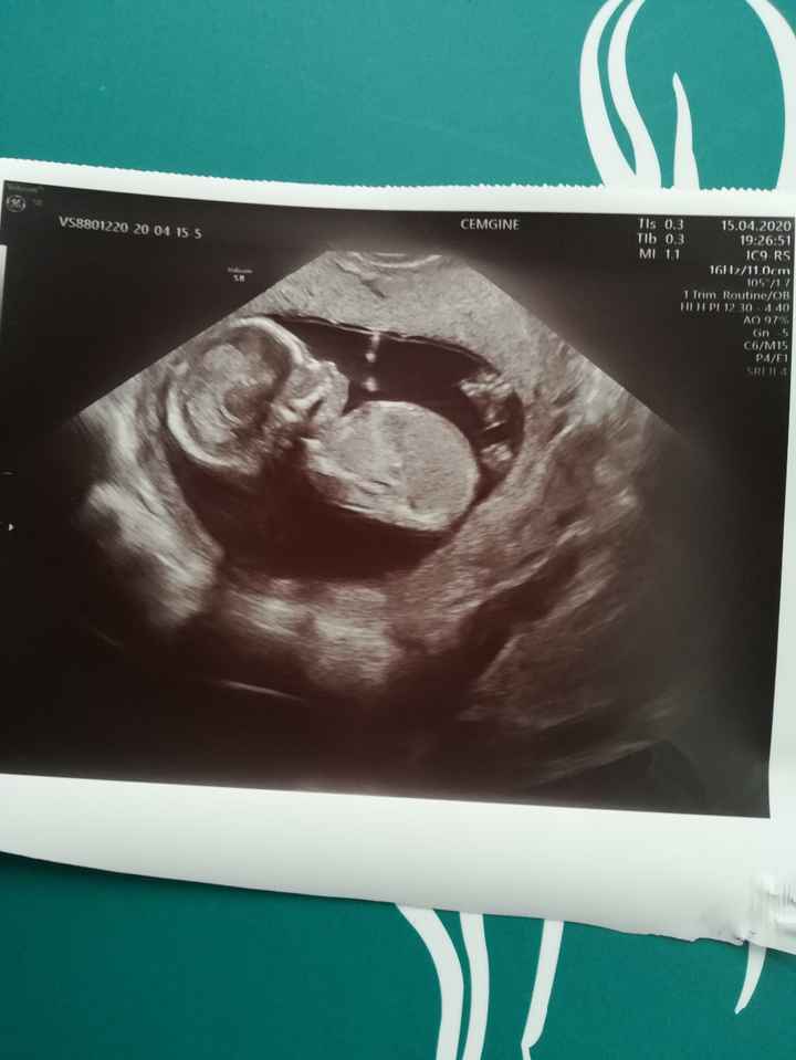 Futuras mamas octubre 2020 - 1