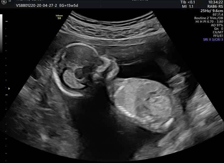 Futuras mamas octubre 2020 - 1
