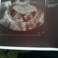 Futuras mamas octubre 2020 - 1