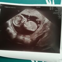 Futuras mamas octubre 2020 - 1