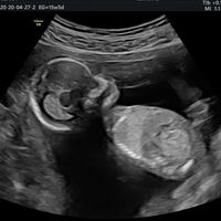 Futuras mamas octubre 2020 - 1