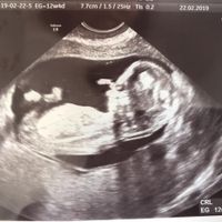 Futuras mamás septiembre 2019 - 1