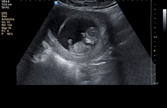 Futuras Mamis Noviembre - 2